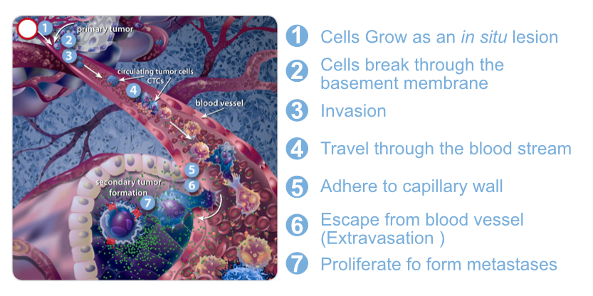 Circulating Tumor Cells as Cancer Biomarkers in the Clinic